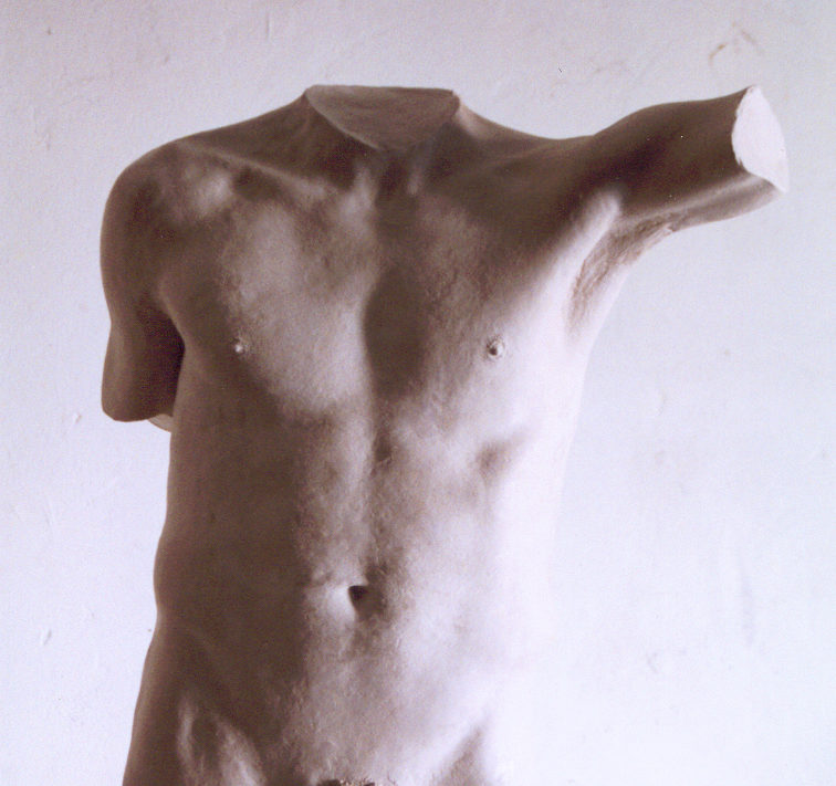 Body cast, 1998